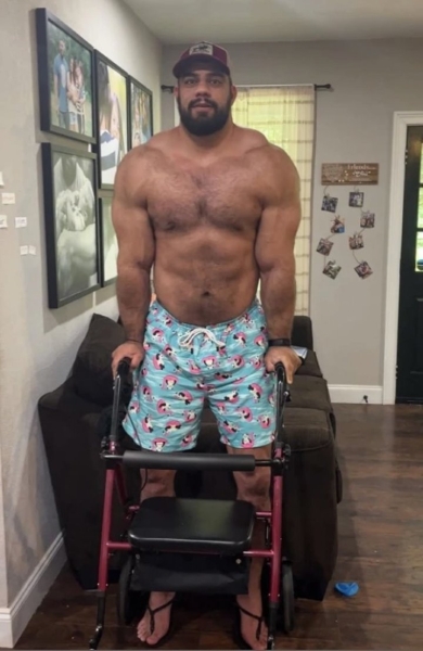 Мужчина потратил 100 тысяч евро, чтобы увеличить свой рост. «Вырос» до двух метров